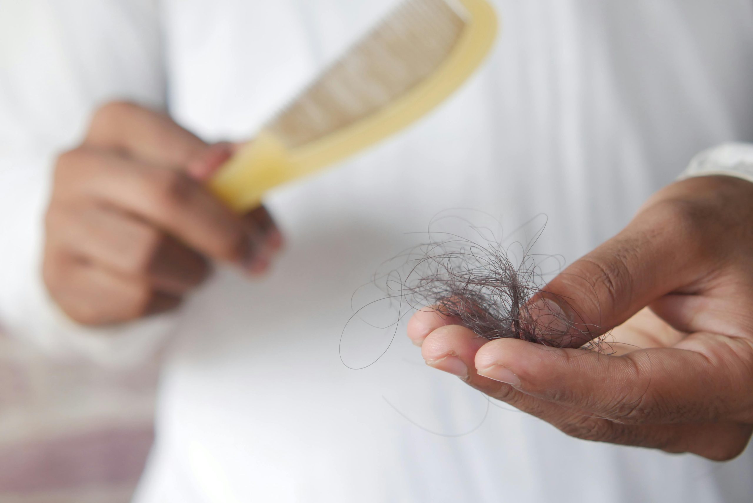 F36 – Looking for a dermatologist specialising in hair loss/hair thinning in London